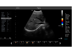 b超儀器監測圖像