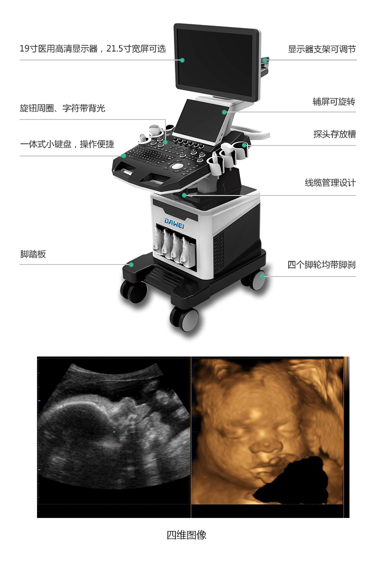 高端四維彩超成像