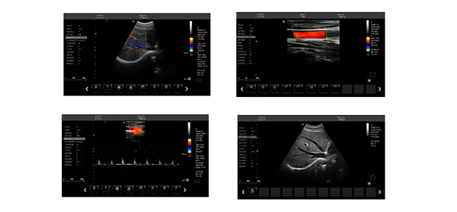 彩超機臨床圖